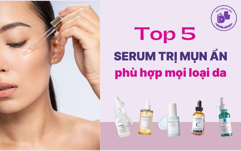 Top 5 serum trị mụn ẩn phù hợp mọi loại da